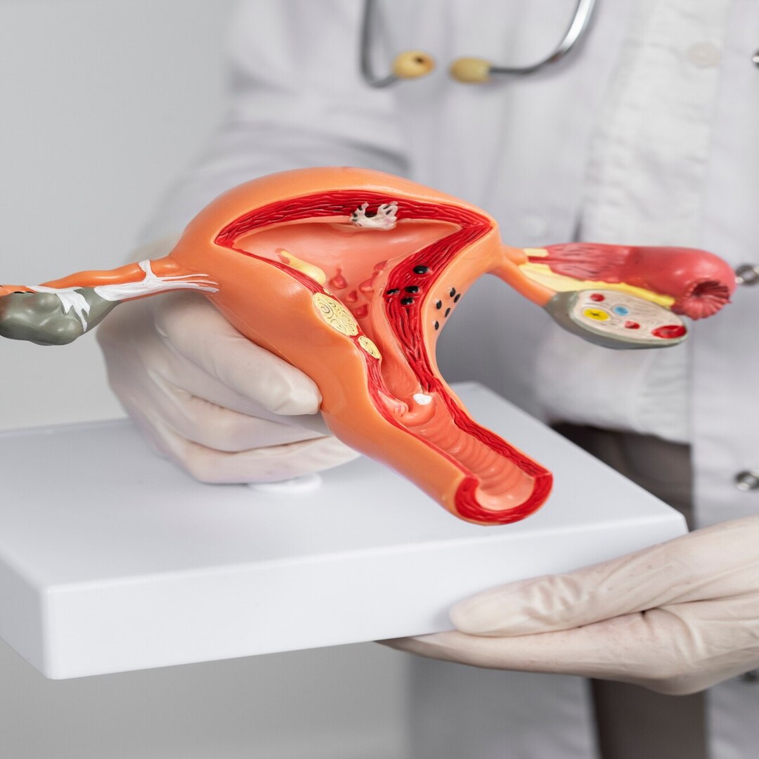 هبوط الرحم: الأسباب والأعراض وطرق العلاج والوقاية