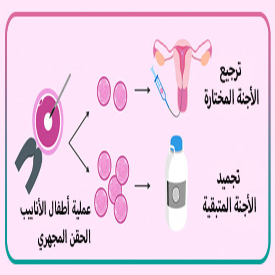 نصائح قبل ارجاع الاجنة المجمدة