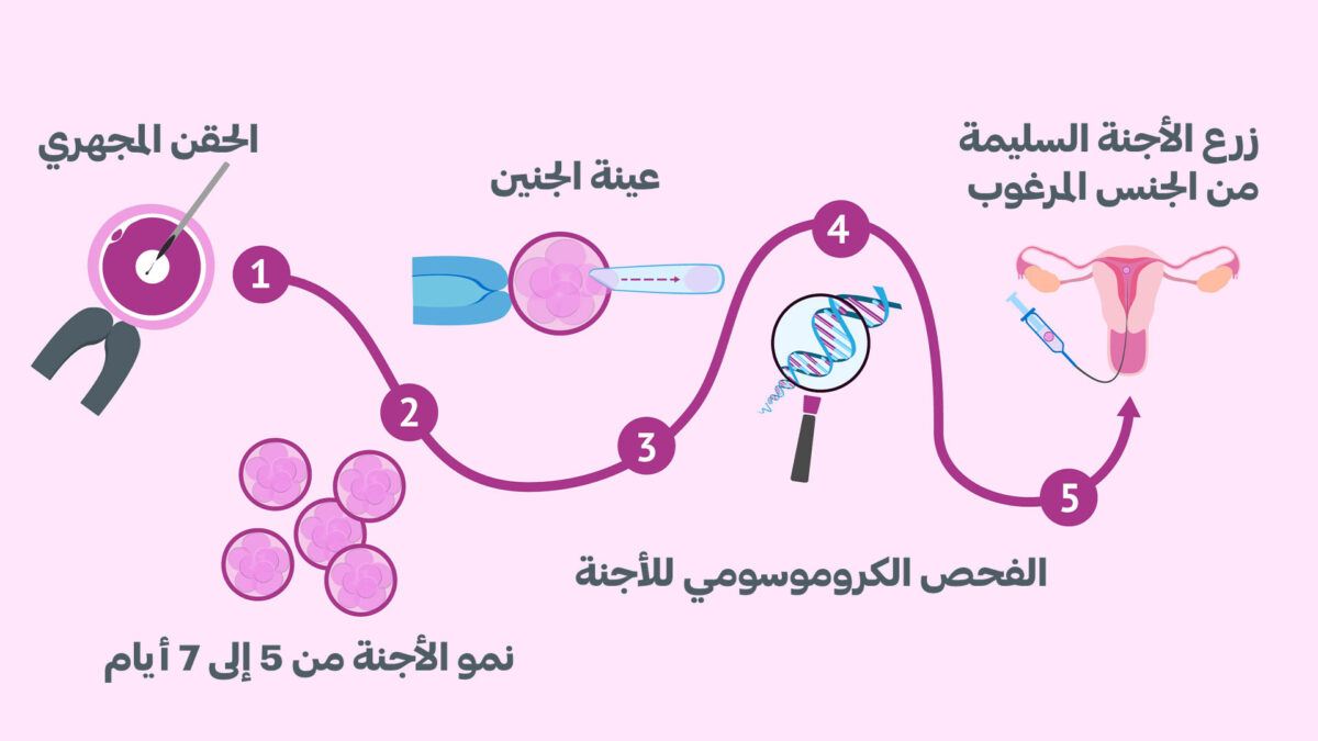 تحديد جنس الجنين : دليل شامل وأحدث التقنيات 