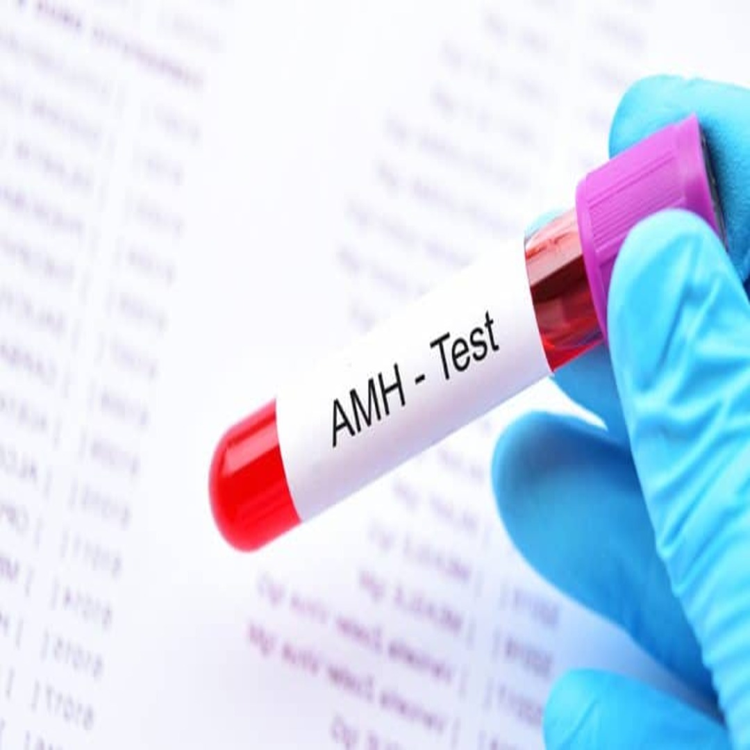 تحليل مخزون المبيض AMH : دليلك الشامل