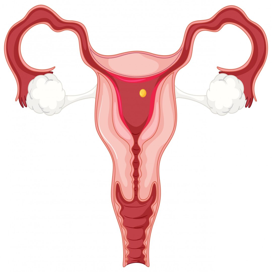 الرحم المقلوب: أسبابه وأعراضه وعلاجه وتأثيره على الخصوبة والحمل